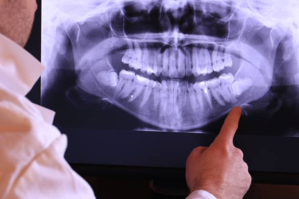 Best Broken Tooth Emergency  in Bratenahl, OH