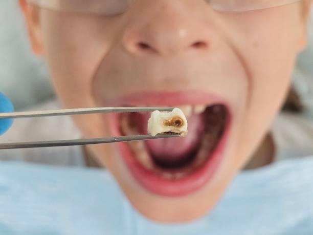Best Emergency Pediatric Dentist  in Bratenahl, OH
