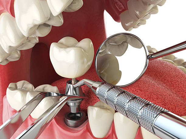 Best Broken Tooth Emergency  in Bratenahl, OH